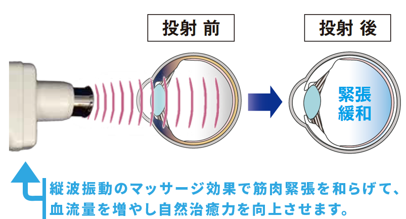 縦波振動のマッサージ効果で筋肉緊張を和らげて、 血流量を増やし自然治癒力を向上させます。