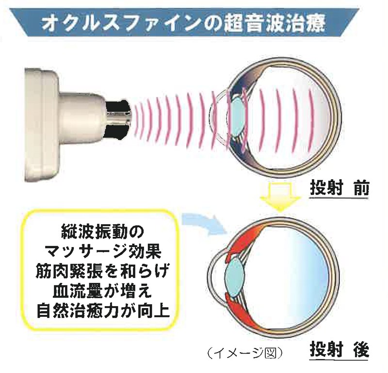 オクルスファイン商品写真